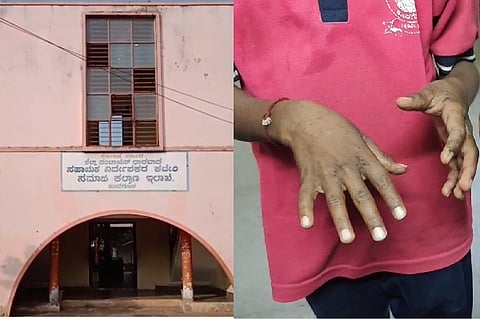 Skin disease: ಕುಂದಗೋಳ ಪಟ್ಟಣದ ಸಮಾಜ ಕಲ್ಯಾಣ ಇಲಾಖೆಯ ಹಾಸ್ಟೆಲ್. ವಿದ್ಯಾರ್ಥಿಗಳ ದೇಹದಲ್ಲಿ ಗುಳ್ಳೆ ಎದ್ದಿರುವುದು.