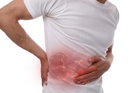 Kidney Stone