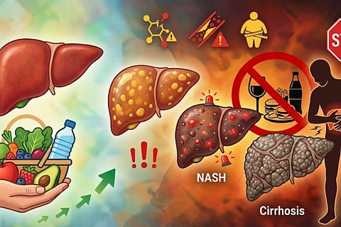 Fatty Liver 