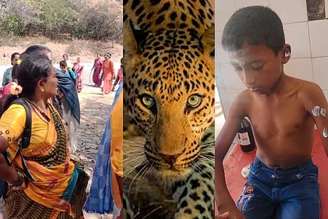 ಮಾದಪ್ಪನ ಬೆಟ್ಟದಲ್ಲಿ ಬಾಲಕನ ಮೇಲೆ ಚಿರತೆ ದಾಳಿ