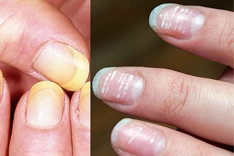 nails 