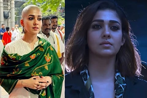 ಟಾಕ್ಸಿಕ್​ ಸಿನಿಮಾ ಬಿಡುಗಡೆಗೂ ಮುನ್ನವೇ ಮುಡಿ ಕೊಟ್ರಾ ನಯನತಾರಾ? ವೈರಲ್​ ಫೋಟೋ ಹಿಂದಿನ ಅಸಲಿಯತ್ತೇನು? Nayanthara 