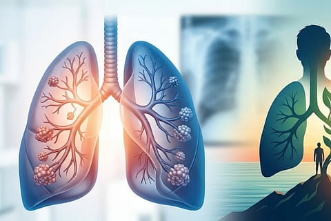 Pneumonia
