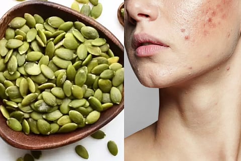 Pumpkin seeds for acne clear skin