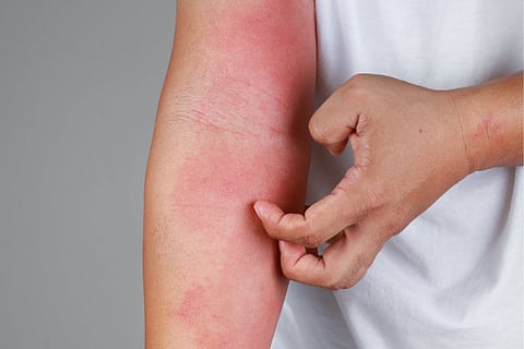 Summer Skin Care Tips