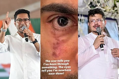 Abhishek Banerjee | ಈ ಗಾಯ ನನ್ನ ಕಥೆ ಹೇಳುತ್ತೆ!...ಯುಎಸ್‌ ಆಸ್ಪತ್ರೆಯಿಂದ ಅಭಿಷೇಕ್ ಪೋಸ್ಟ್