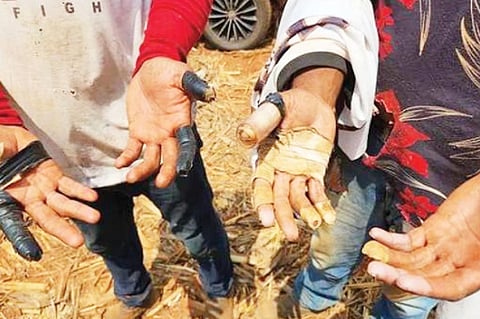 ಸಾಂದರ್ಭಿಕ ಚಿತ್ರ 