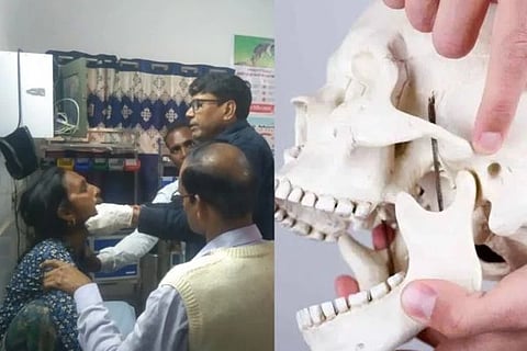 ಮಹಿಳೆಯ ದವಡೆ ಜರುಗಿದ ದೃಶ್ಯ