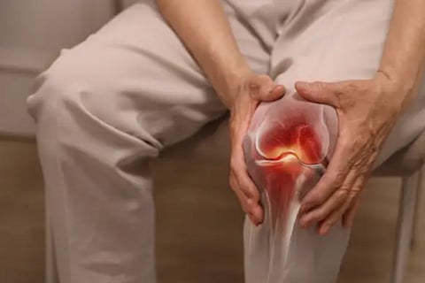 arthritis