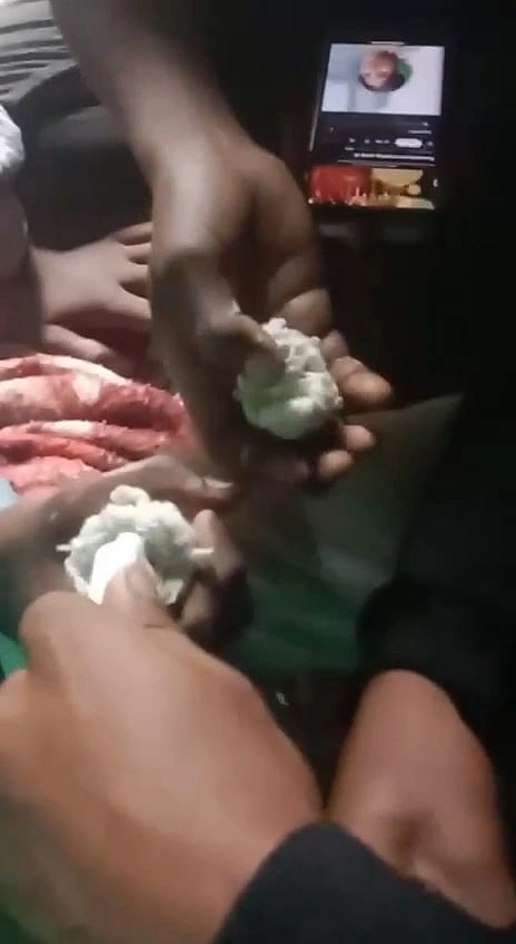  ಸಲ್ಯೂಷನ್ ಮತ್ತಿನಲ್ಲಿ ಅಪ್ರಾಪ್ತ ಬಾಲಕರು