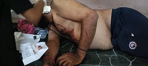 ಚಾಕು ಇರಿತ