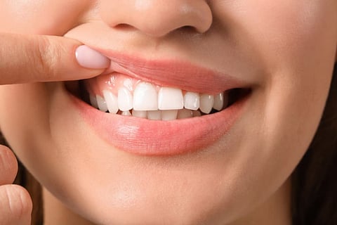 dental