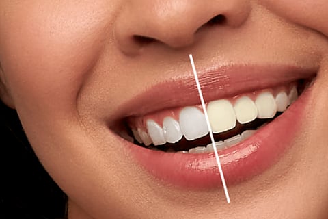 Dental Care 