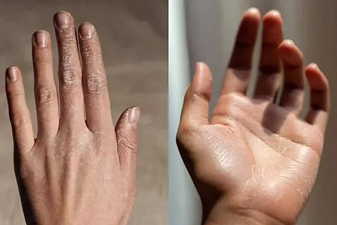 ಸಾಂದರ್ಭಿಕ ಚಿತ್ರ