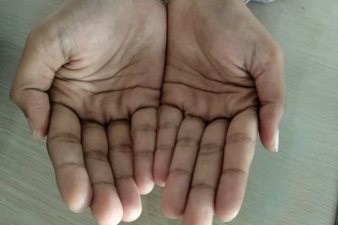 ಸಾಂದರ್ಭಿಕ ಚಿತ್ರ