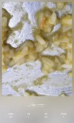 ಹಾಸ್ಟೆಲ್‌ ಅನ್ನದಲ್ಲಿ ಹುಳು ಪತ್ತೆಯಾಗಿರುವುದು 
