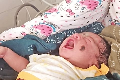 ಕಲಘಟಗಿ ತಾಲೂಕು ಆಸ್ಪತ್ರೆಯಲ್ಲಿ ನವಜಾತ ಶಿಶುವಿಗೆ (Newborn baby) ಚಿಕಿತ್ಸೆ ನೀಡಲಾಯಿತು.