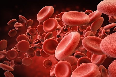 sickle cell anemia