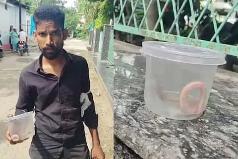 ಕಚ್ಚಿದ ಹಾವನ್ನೇ ಜೀವಂತವಾಗಿ ಆಸ್ಪತ್ರೆಗೆ ಹೊತ್ತು ತಂದ ಯುವಕ! (Snake Bite ಚಿತ್ರ Instagram)