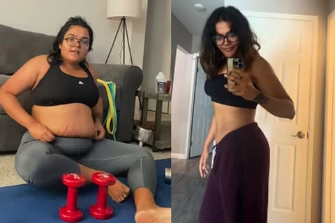 Weight Loss Journey  ಸಾಂದರ್ಭಿಕ ಚಿತ್ರ