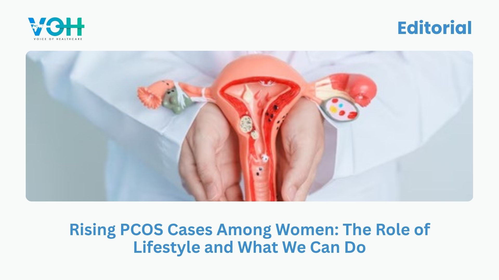 Rising PCOS Cases Among Women: The Role of Lifestyle and What We Can Do