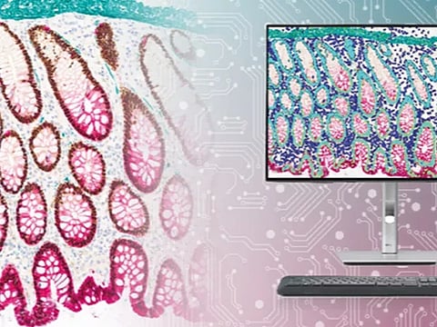 Leica Biosystems Launches ChromoPlex III: A Simplified, High-Performance Chromogenic Multiplex IHC Detection System for Research Use