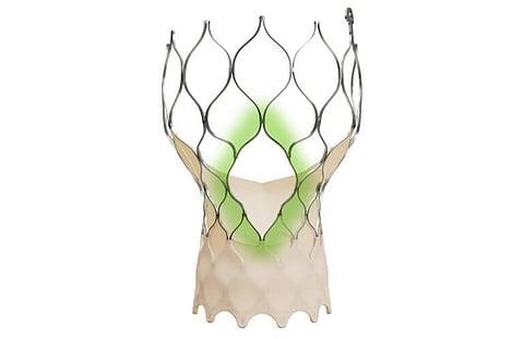 Medtronic Launches Evolut FX+ TAVI System in India for Severe Aortic Stenosis