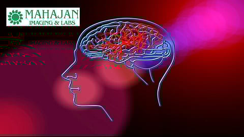 Rising Stroke Cases Among Young Indians