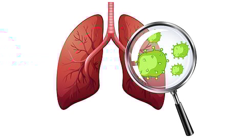New Antibiotic Sorfequiline Shows Promise in Cutting TB Treatment Duration