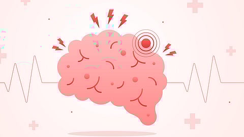 Bayer Shares Rise as Stroke Prevention Drug Shows Promise