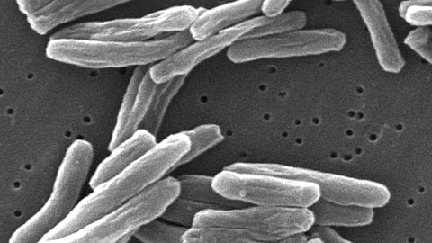 WHO Issues New Policy Brief For Strategic TB Programme Planning