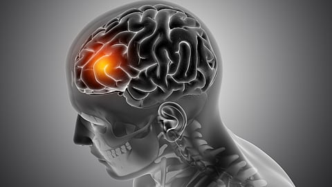 Indian Scientists Find Rare Gene Causing Neurological Disorders In Children