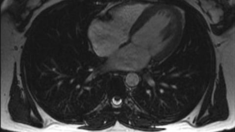 New ASCEND–Konica Minolta Partnership Boosts Cardiovascular Imaging