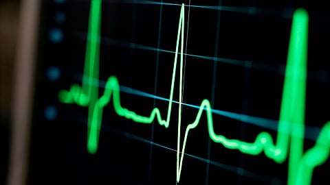 Omron Healthcare Announces Global ECG Strategy For Advanced Cardiac Care