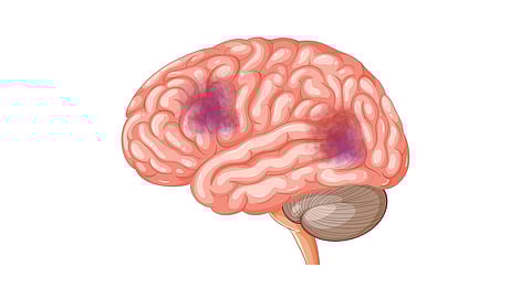 Genetic Pathway Linked to Neurodevelopmental Defects Identified In Offspring, Study Reveals