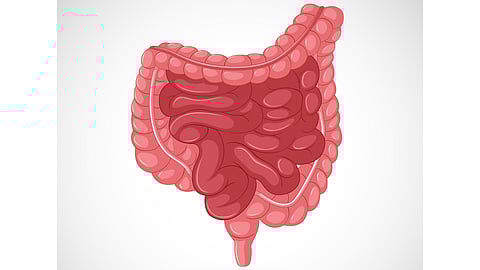 US FDA Approves MRM Health’s MH002 Phase 2b Study In Mild-To-Moderate Ulcerative Colitis