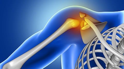 4Moving Biotech’s 4P004 Receives FDA IND Nod For Osteoarthritis Treatment