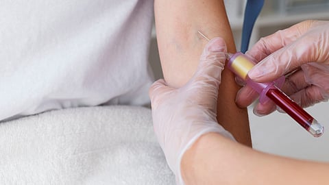 Expert-Backed TPAG Paper Recommends Systemic Blood Transfusion Reforms