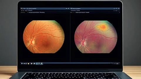 CDSCO Clears Forus Health’s AI-Based Retinopathy Screening Solution For Indian Clinics