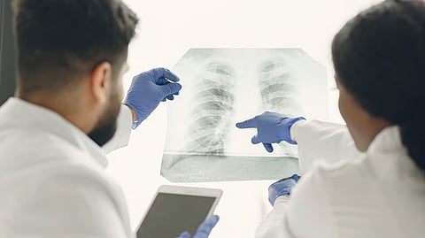 Short-Course Oral Regimens For MDR-TB Cost-Effective In India: ICMR Study