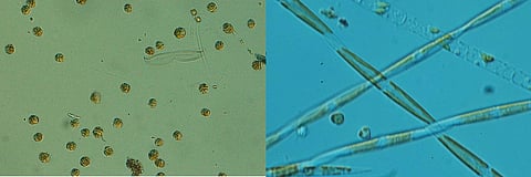 Imágenes tomadas mediante microscopía óptica (DIC = contraste de interferencia diferencial), capturadas a 100× y 400×.