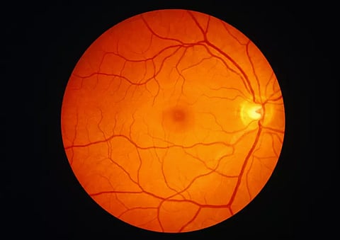 Retina
