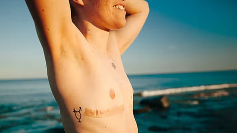 Mastectomy