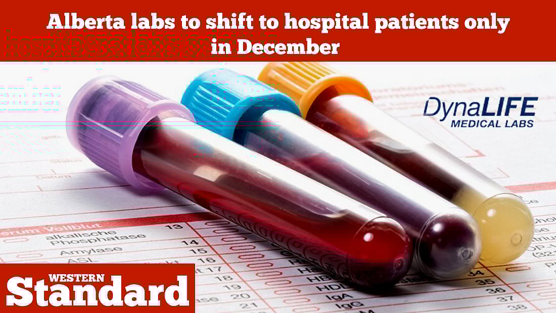 Alberta labs to shift to hospital patients only in December