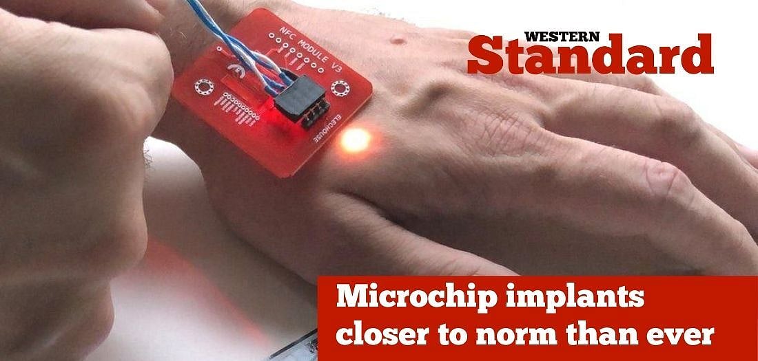 Microchip implants closer to norm than ever
