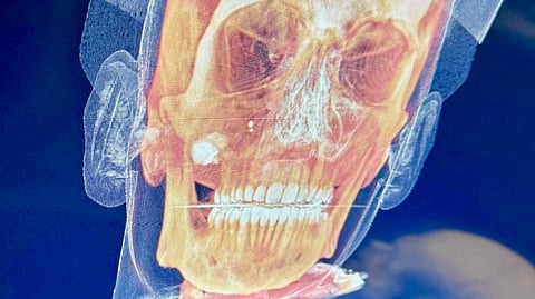 A medical scan of the victim 